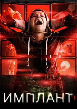Имплант (2021)